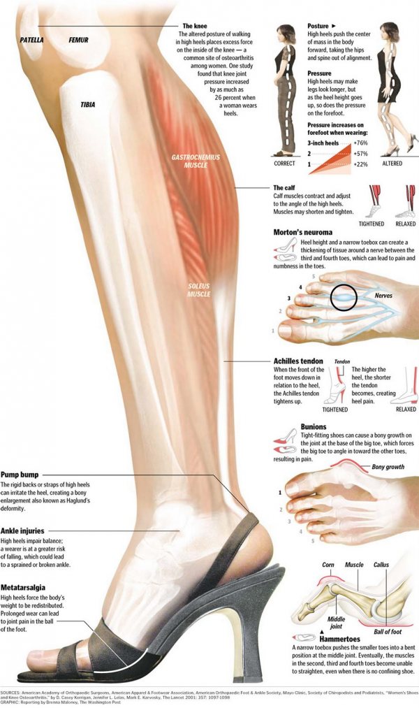 Pain In Calf Wearing Flat Shoes Pain In Calf Wearing Flat Shoes
