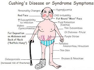 The classic signs and symptoms of Cushing syndrome pictures