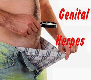 Como Curar el Herpes en el Pene con Tratamiento Natural para Herpes Genital Masculino herpes-en-el-pene-como-curar-tratamiento-natural-genitales