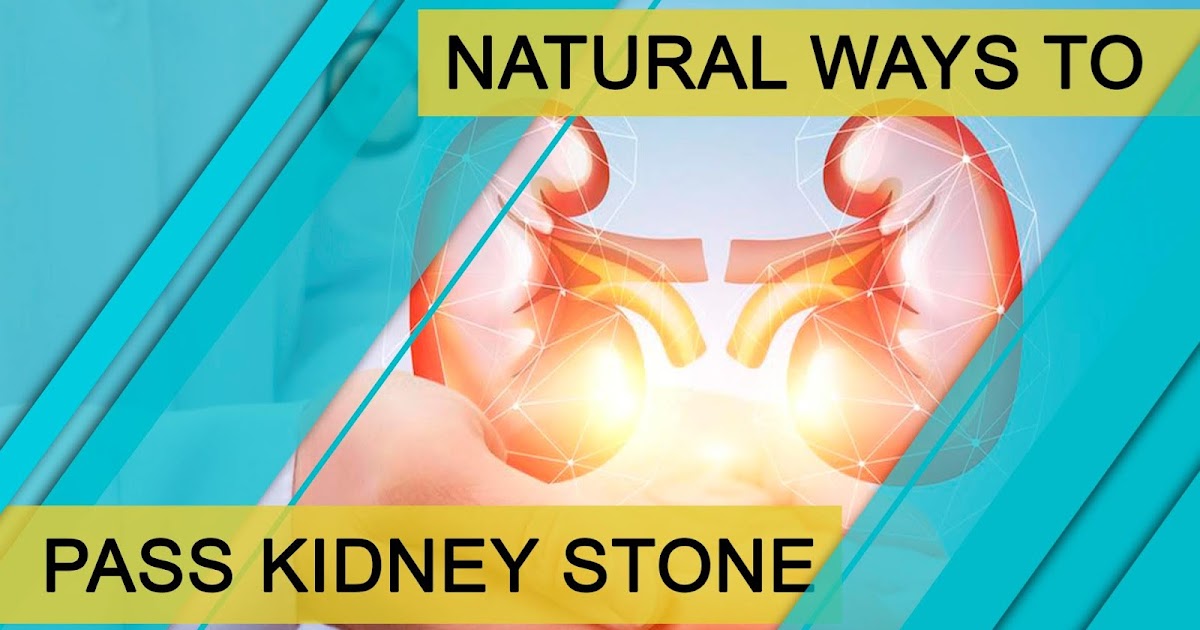 Home Remedies for Kidney Stones, Natural Ways to Pass Kidney Stone