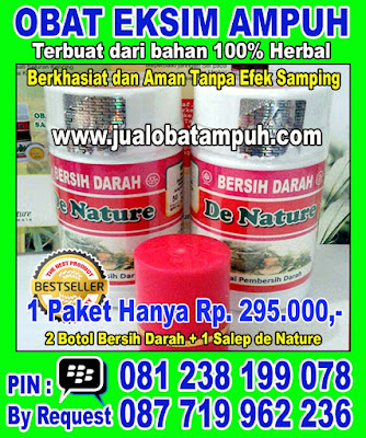 Obat Herbal Untuk Penyakit Eksim