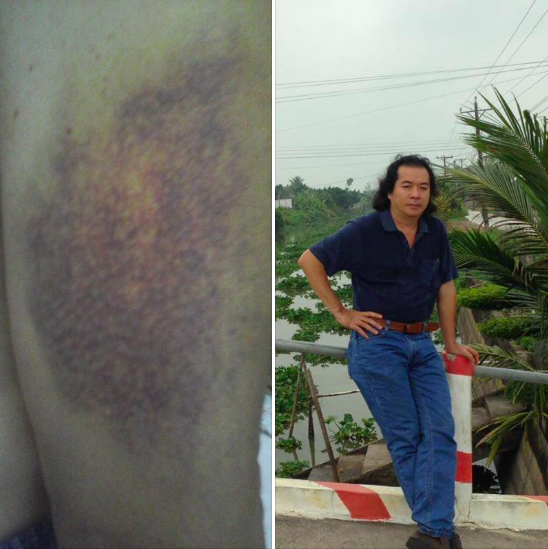 [Image: Screen%2BShot%2B2018-06-21%2Bat%2B9.38.01%2BPM.png]