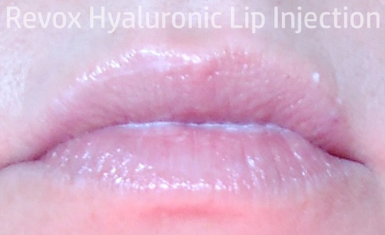 Revox rellenar labios