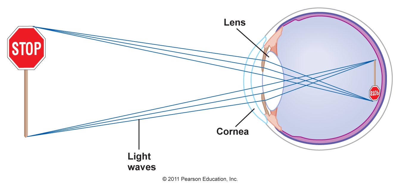 Eye Care and Vision Refractive (= focussing) errors, and how