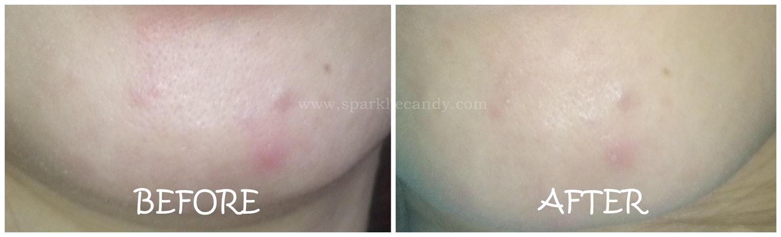 drying lotion before and after