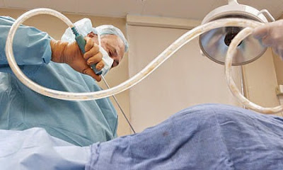 Cara menurunkan berat badan tanpa sedot lemak