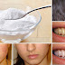 Baking Soda
