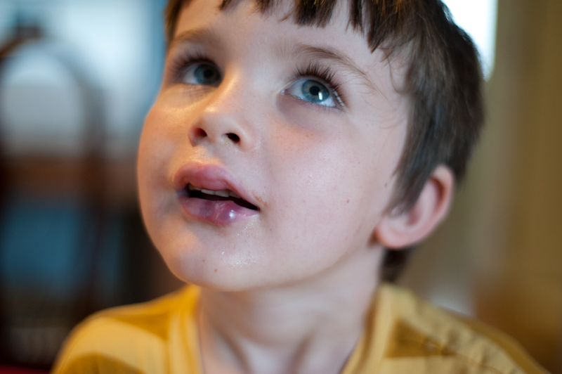 Across the Sea Mr. Big Lips