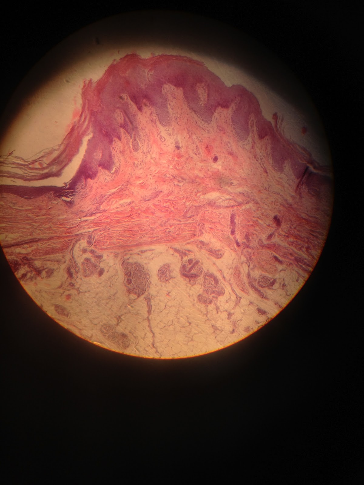 atlas de histología: SISTEMA TEGUMENTARIO