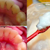 4 Easy Steps That Can Help You Whiten, Remove Tartar And Gingivitis On Your Teeth