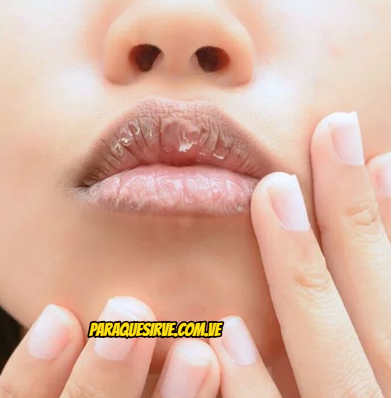 8 Remedios Caseros para Labios Resecos y Quemados 8 Remedios Caseros para Labios Resecos y Quemados