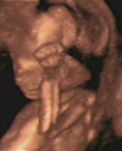 Hafta hafta bebeğin ultrason görüntüleri-17.hafta
