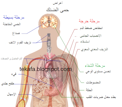موقع معلوماتي عن أعراض حمى الضنك وعلاجها
