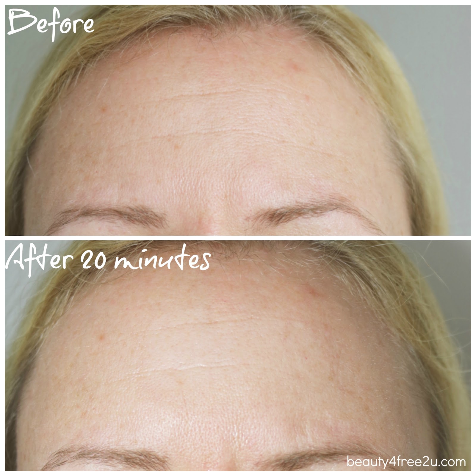 WRINKLES SCHMINKLES REVIEW DO THESE SILICONE PADS REMOVE WRINKLES?