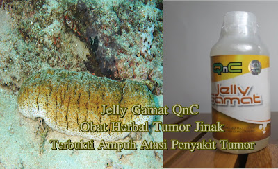 Cara Ampuh Menghilangkan Tumor Jinak Di Leher Tanpa Operasi Cara Ampuh Menghilangkan Tumor Jinak Di Leher Tanpa Operasi