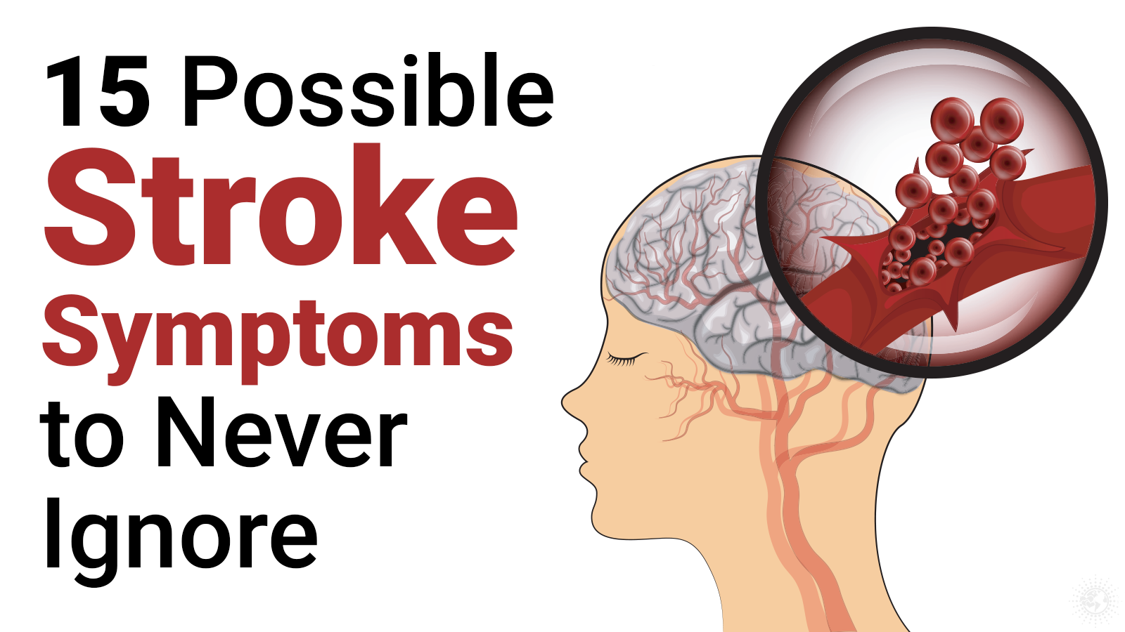 15 Stroke Symptoms That Doctors Ask You Not To Ignore