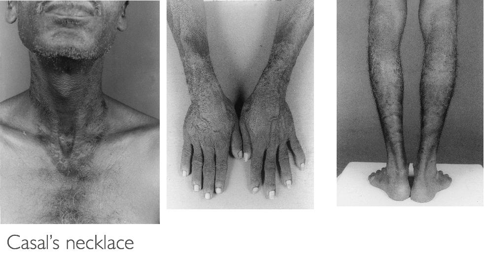 Hospitalist ~なんでも無い科医の勉強ノート~