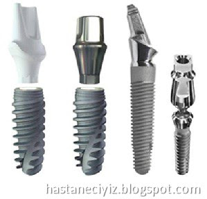 implant diş nedir