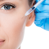 7 Conditions that can be overcome with Botox