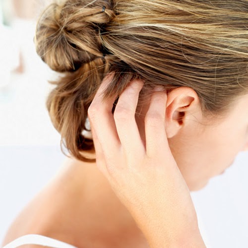 Hair Problems and Treatment ECZEMA ON THE SCALP