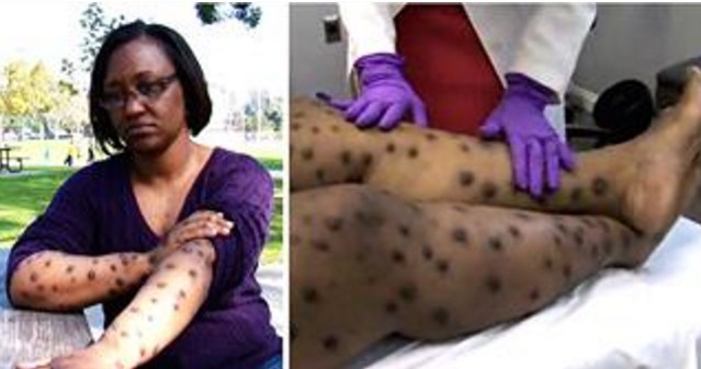 yellow bone dream gone wrong consequences of skin bleaching yellow bone dream gone wrong consequences of skin bleaching