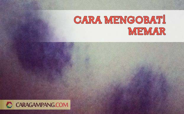 Cara Mengobati Luka Memar Cara Mengobati Luka Memar