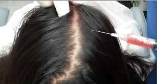 tricoligo capelli donna