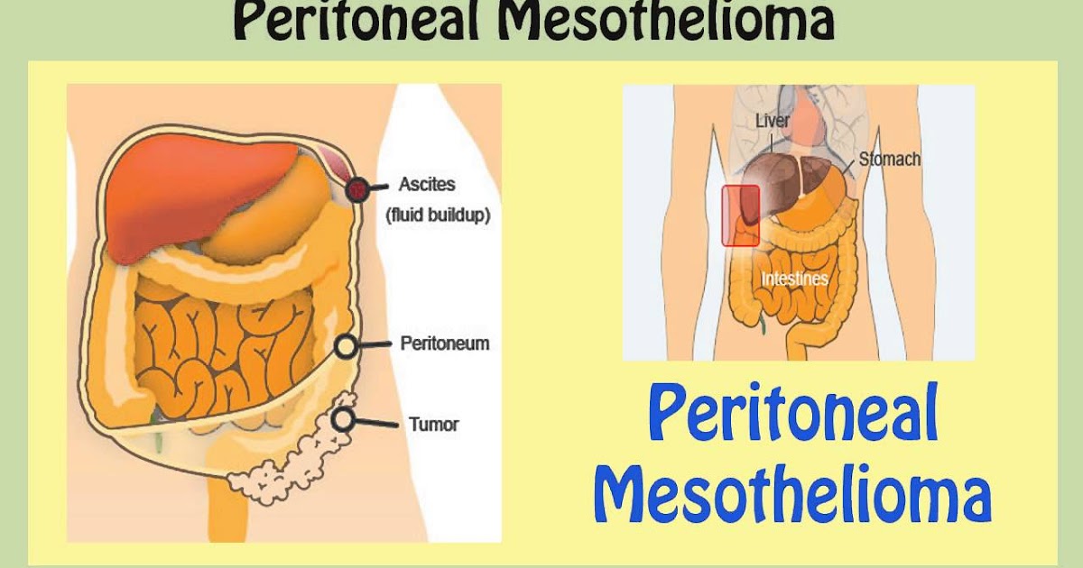 what is reactive mesothelial cells in pleural fluid