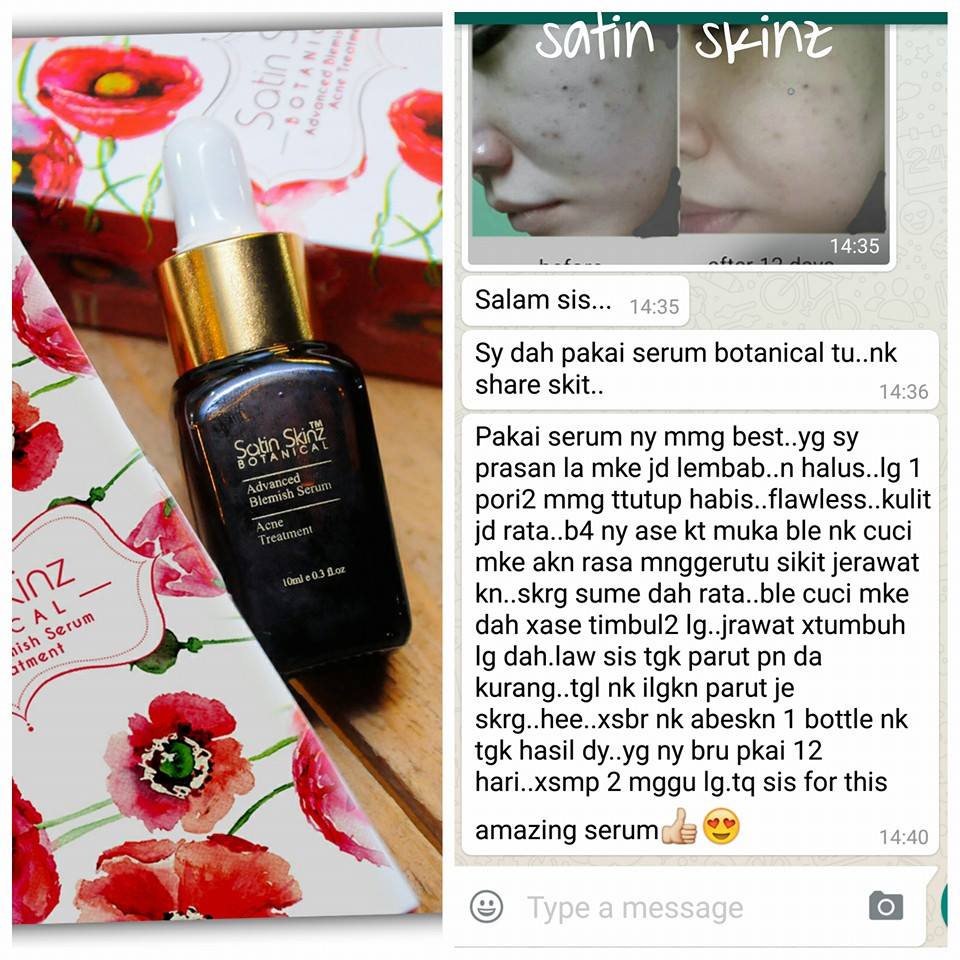 Satin Skinz Facial Acne Cream / Satin Skin Acne Serum / Satin Skinz Facial Green Tean Acne Murah
