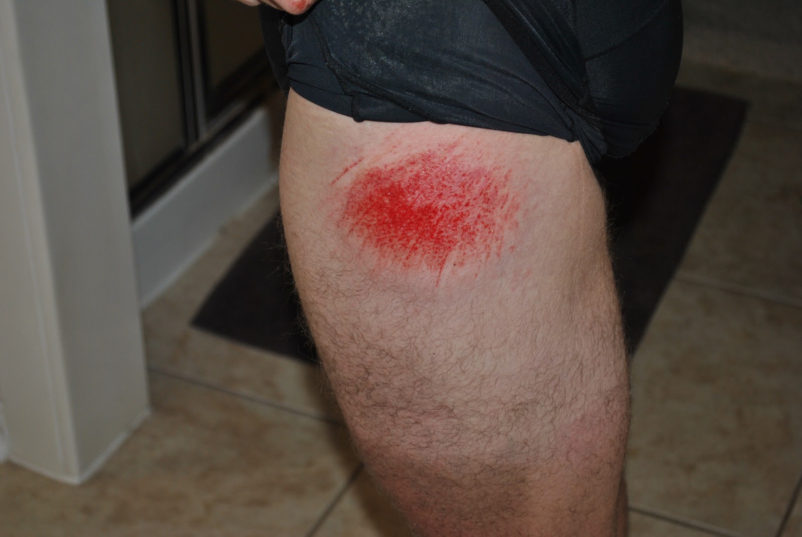 Dangle the Carrot An Endurance Sports Blog My Bike Crash and Road