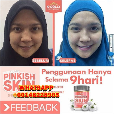 kcolly pinkish skin testimoni