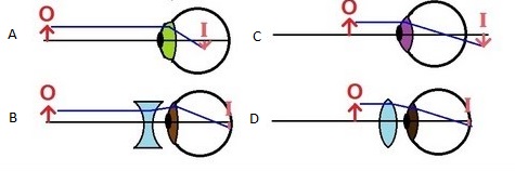 What is +plus and -Minus number of eye glasses?? - Learn Something New