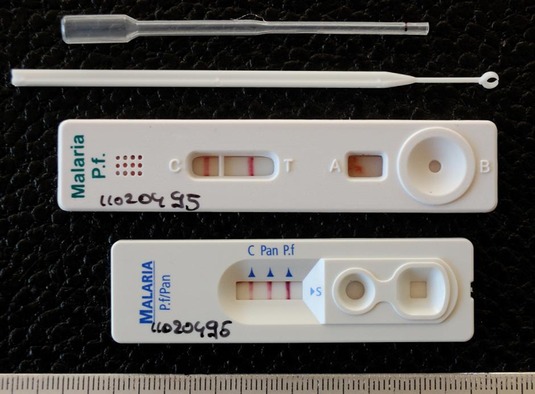 TEST DARAH MALARIA MAKIN MUDAH SAJA DENGAN RDT Rapid Diagnostic Test 