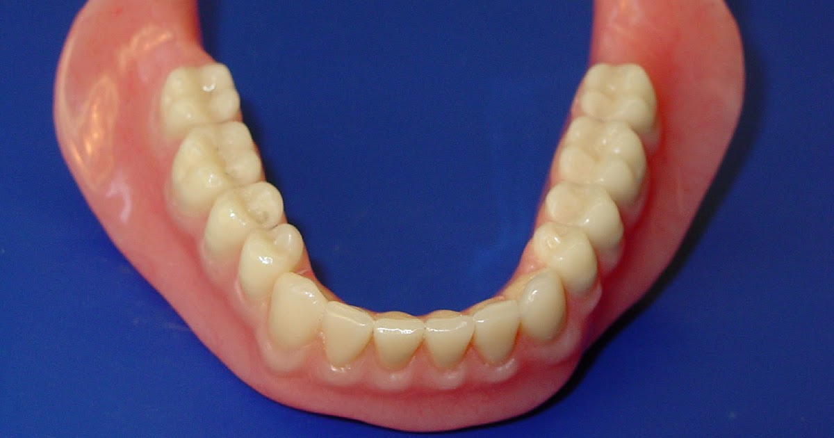 Съемный протез (6-14 зубов) термо Джет. Полносъемный протез нижней челюсти. Пластмассовый съемный протез.