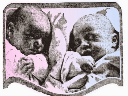 Embarazo de gemelos