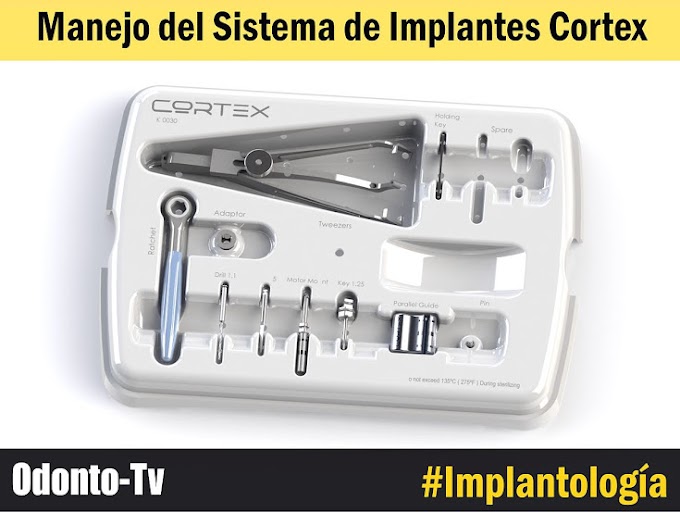 WEBINAR: Manejo del Sistema de Implantes Cortex - Dr. Oscar Ramón