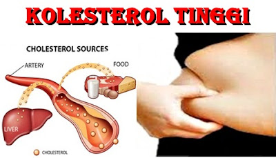  turunkan kolestrol