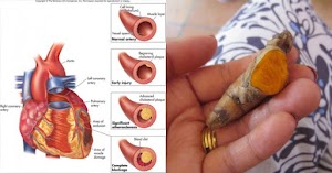 Selon une étude : Une pincée de curcuma est plus efficace qu’une heure d’exercice.