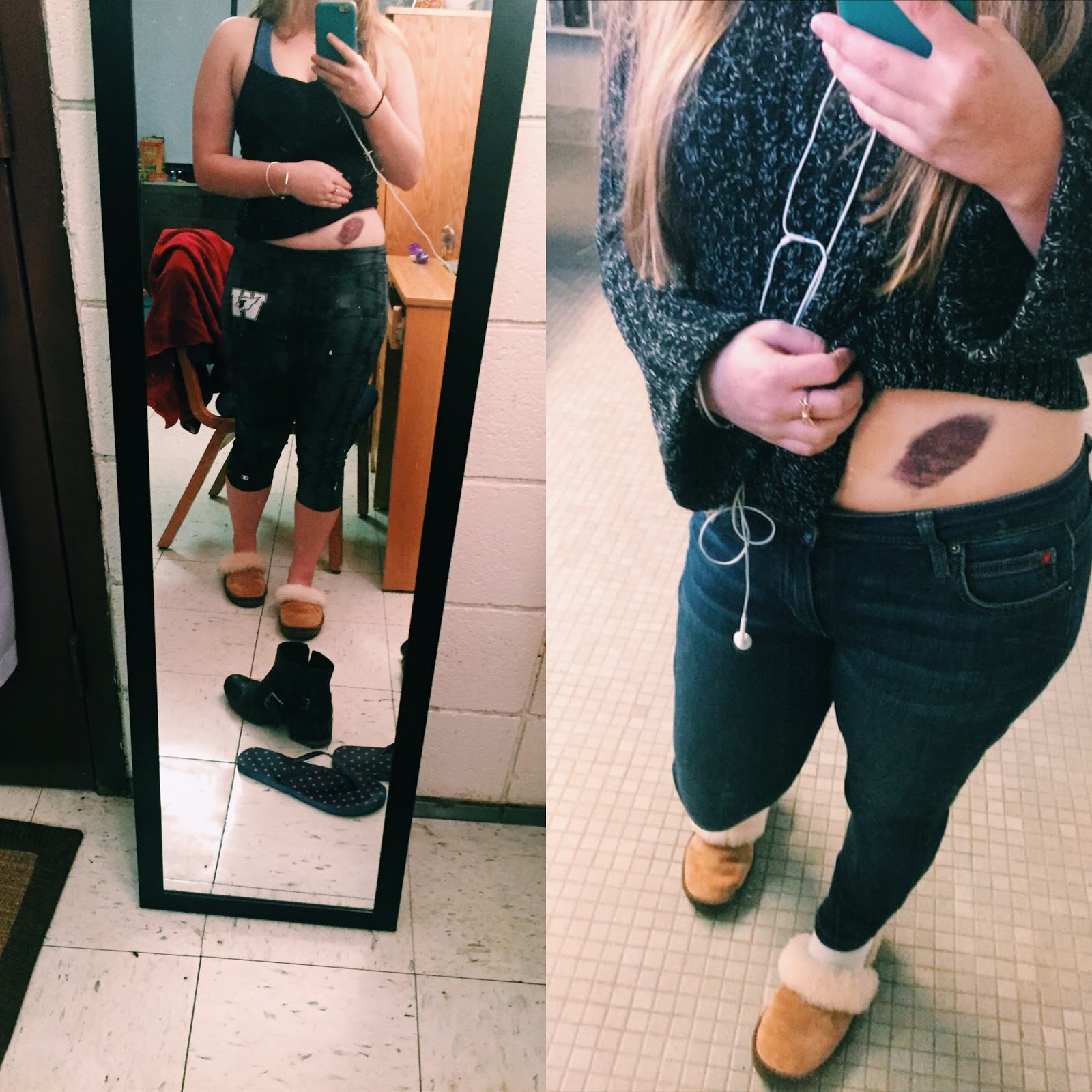 Dealing with the Emotions of Medical Trauma The One Year Anniversary