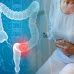 COLON CANCERS! SYMPTOMS AND IT'S EFFECTS ON YOUR POO-POO (FECES)