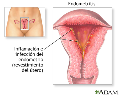 dolor pélvico en áfrica