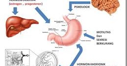 askep hiperemesis gravidarum