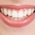 How to Whiten Teeth
