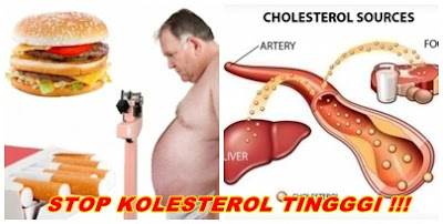 http://lemburherbal.blogspot.co.id/2015/11/obat-penurun-kolesterol-tercepat.html