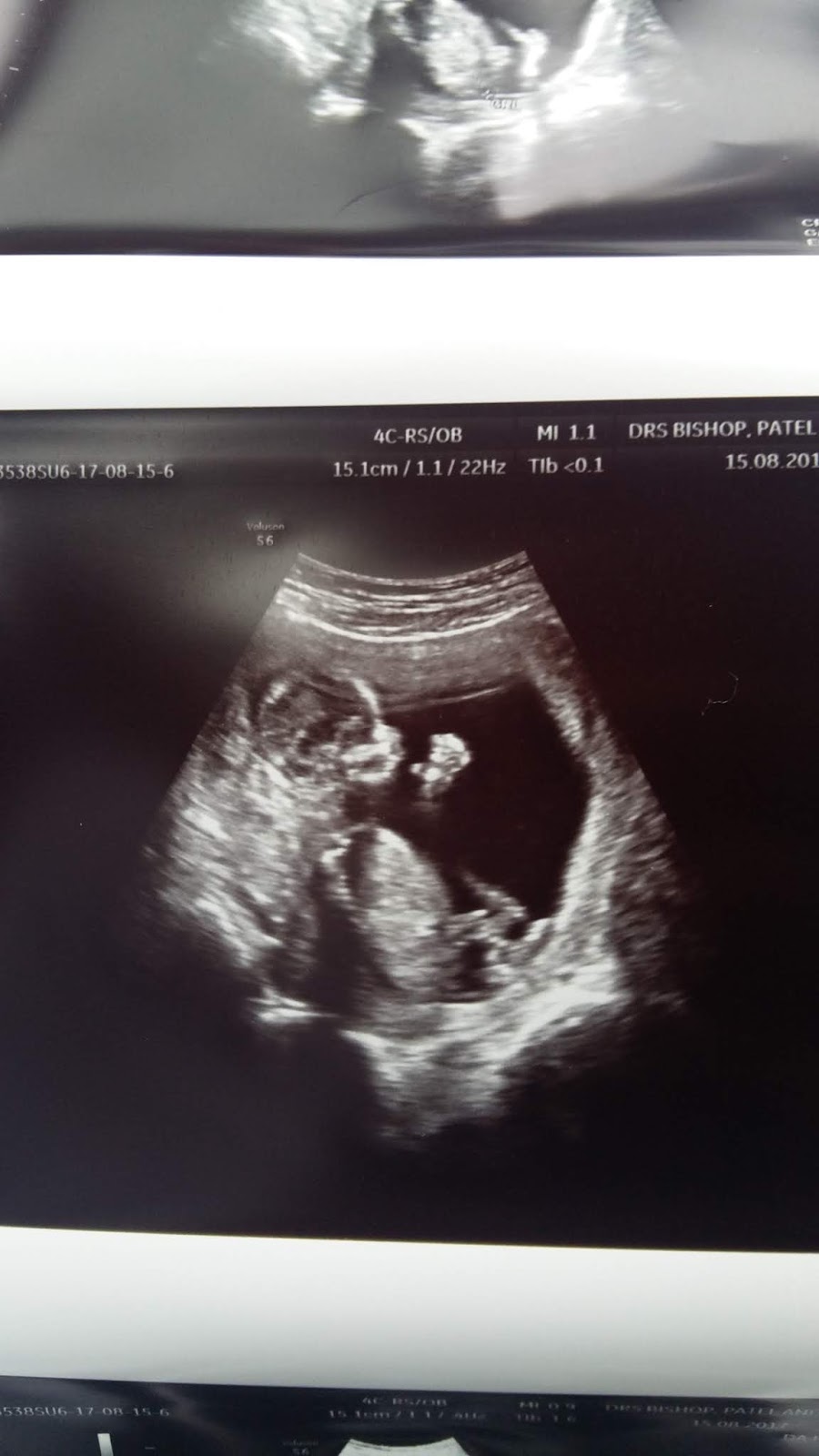 MY FIRST GYNECOLOGIST VISIT