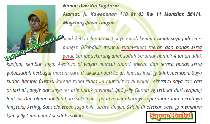 Cara Ampuh Mengobati Impetigo Secara Total Cara Ampuh Mengobati Impetigo Secara Total