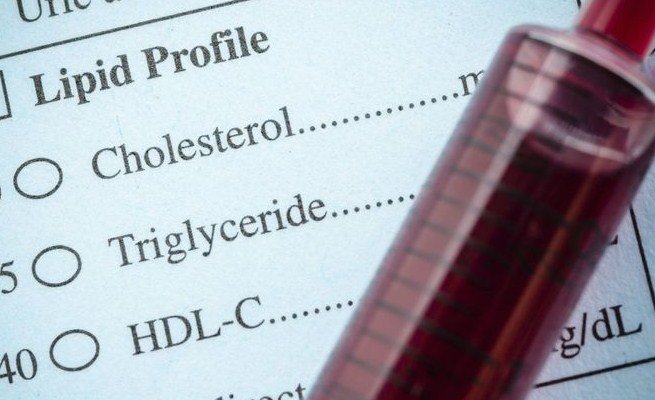 What Is Oxidized LDL Cholesterol and Why Is It Important? What Is Oxidized LDL Cholesterol and Why Is It Important?