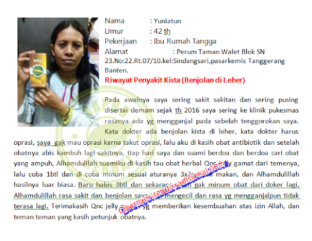 Cara Mengobati Gondok Secara Alami Dan Paling Ampuh Cara Mengobati Gondok Secara Alami Dan Paling Ampuh