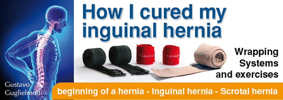 Shut Inguinal hernia without surgery