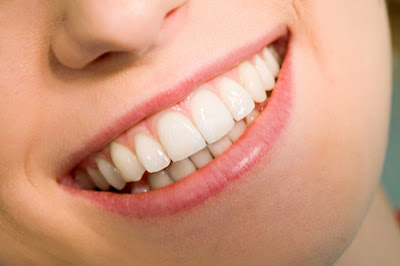 Cách làm răng đều đẹp hiệu quả và an toàn nhất